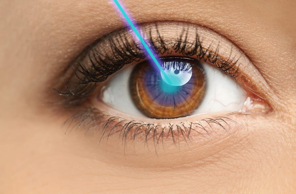 A close up of a woman's eye with a blue laser directed to the center of her eye, illustrating what it's like to have laser eye surgery