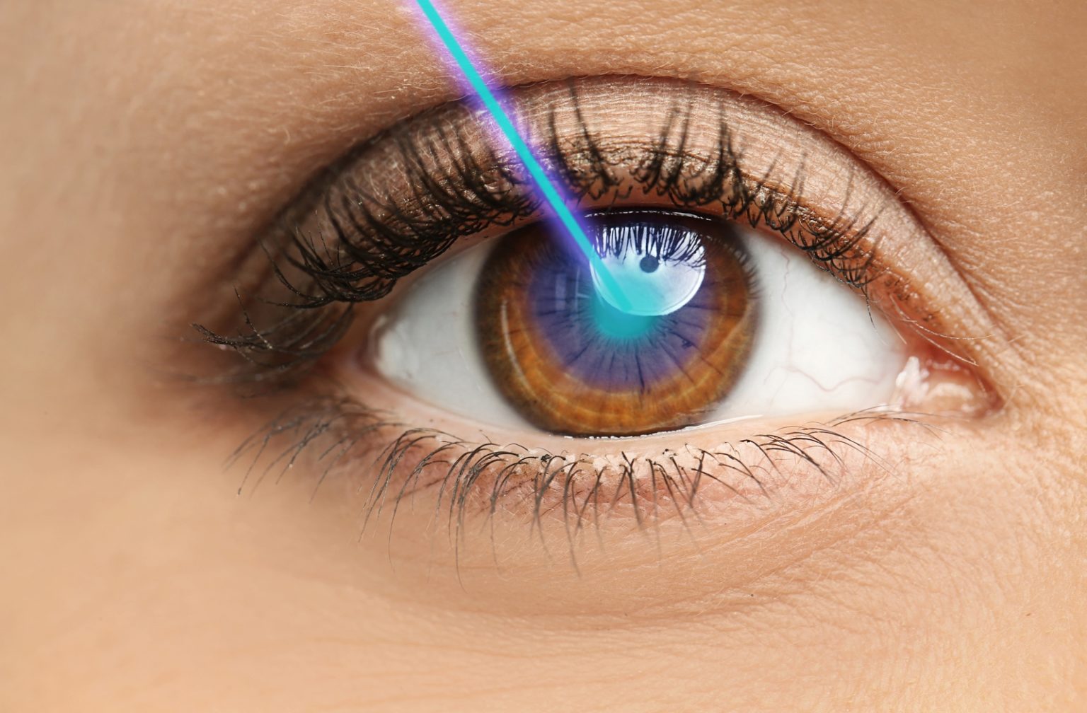 how-long-does-laser-eye-surgery-last-calgary