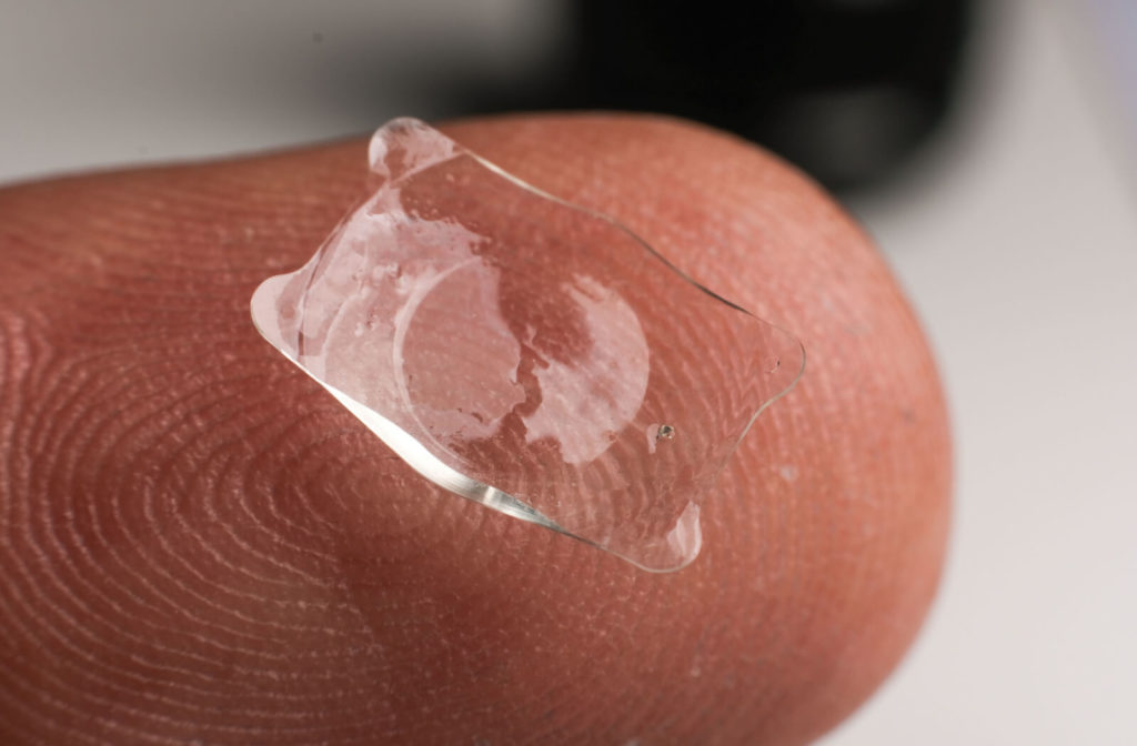 A close-up of an Implantable Collamer Lens (ICL) placed at the tip of a human finger. ICL could be a more maintenance-free alternative for contact lenses.