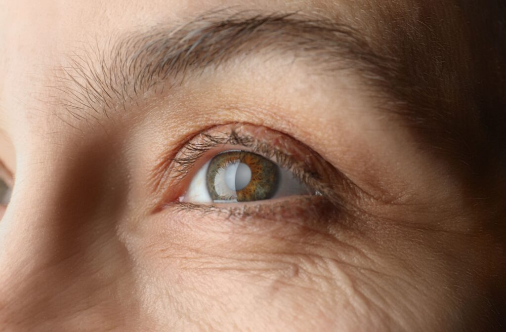Extreme close-up of a brown-eyed person's right eye. The eye has signs of cataracts.