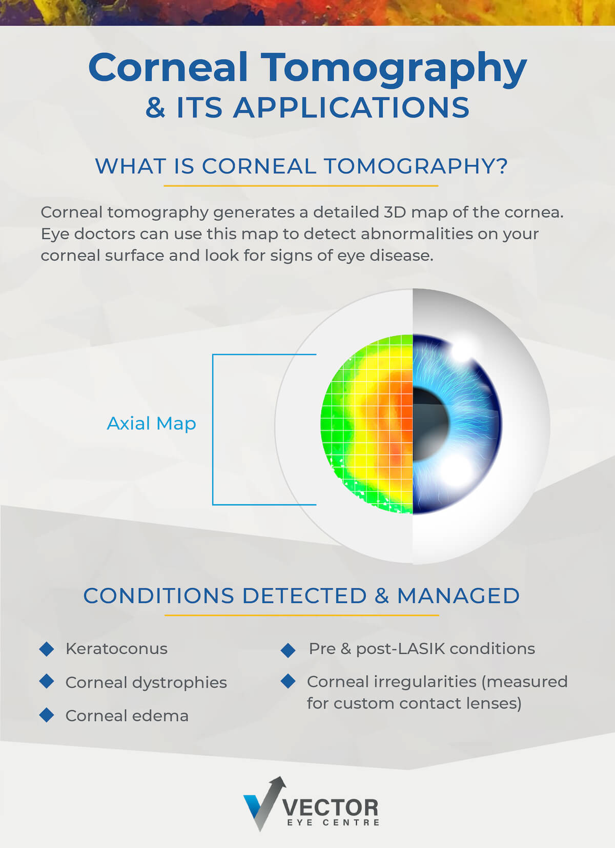 Infographic on corneal tomography and its applications.