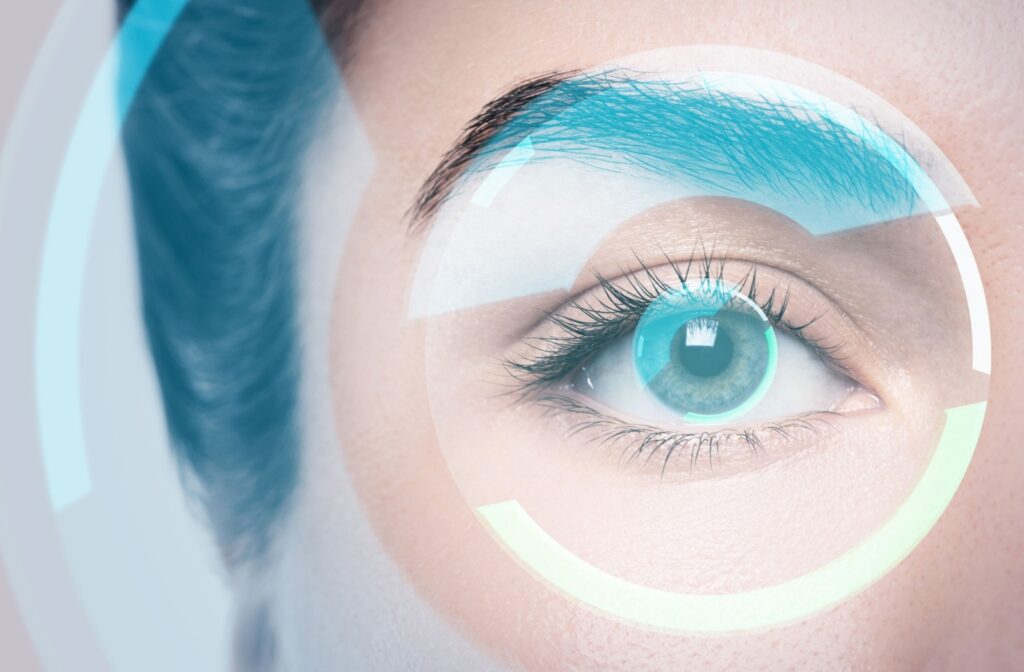 Close-up of an eye with a blue digital graphic circling the cornea, representing refractive eye surgery.