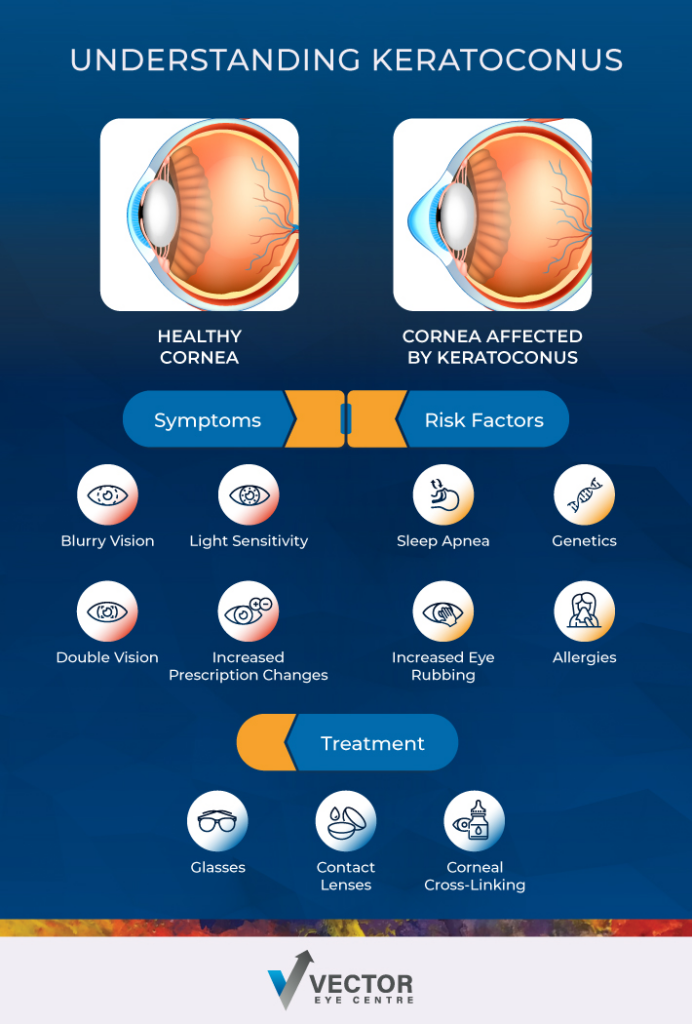 Infographic showcasing the symptoms, risk factors, and treatment option for keratoconus